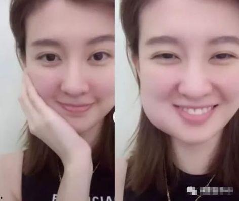 明星网红拔智齿视频,揭秘明星网红口腔护理秘诀